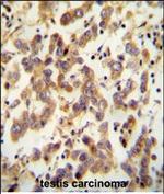 CT173 Polyclonal Antibody