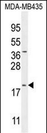 CT173 Antibody in Western Blot (WB)