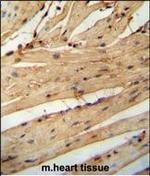 LARP6 Polyclonal Antibody