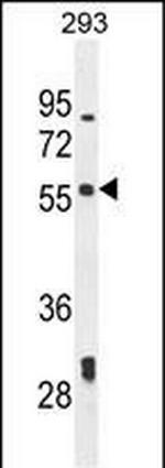 LARP6 Antibody in Western Blot (WB)