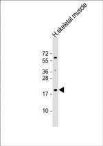 IMMP1L Polyclonal Antibody