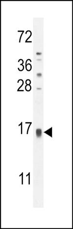 TCL6 Polyclonal Antibody
