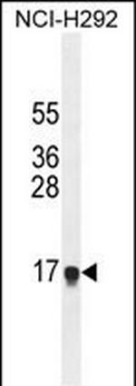HEPN1 Polyclonal Antibody