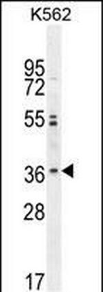 OR2M3 Polyclonal Antibody