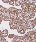 WDR41 Polyclonal Antibody