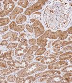 WDR41 Antibody in Immunohistochemistry (Paraffin) (IHC (P))