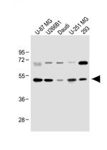 WDR41 Antibody in Western Blot (WB)