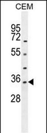 LDHAL6A Polyclonal Antibody