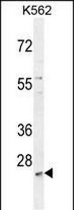 MCART2 Antibody in Western Blot (WB)