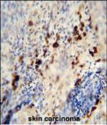 LCE1A Polyclonal Antibody