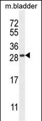 TIFAB Polyclonal Antibody