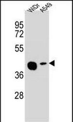 AMAC1L2 Antibody in Western Blot (WB)
