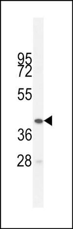 BTNL3 Polyclonal Antibody