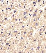 SLC16A11 Polyclonal Antibody