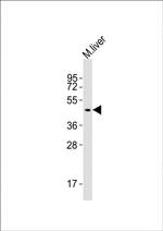 SLC16A11 Antibody in Western Blot (WB)