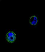 VPS52 Polyclonal Antibody
