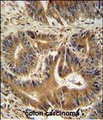 VPS52 Antibody in Immunohistochemistry (Paraffin) (IHC (P))