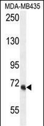 VPS52 Antibody in Western Blot (WB)