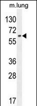 NFE2L1 Polyclonal Antibody