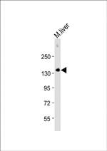 CD31 Antibody in Western Blot (WB)