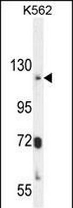 ATP8A2 Polyclonal Antibody
