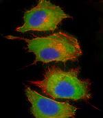 Complement Factor H Antibody in Immunocytochemistry (ICC/IF)
