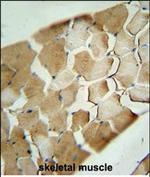 CDKN2C Polyclonal Antibody