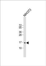 CDKN2C Antibody in Western Blot (WB)