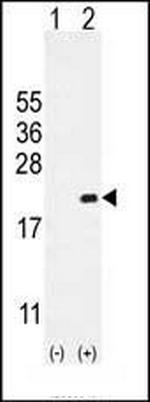 CDKN2C Antibody in Western Blot (WB)