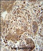 TAGAP Polyclonal Antibody