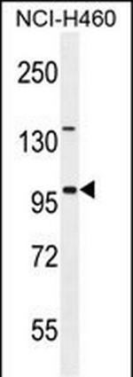 ITIH5 Antibody in Western Blot (WB)