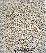 ZC3H12A Polyclonal Antibody
