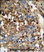 DMP4 Polyclonal Antibody