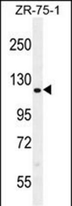 CCD33 Polyclonal Antibody