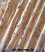 TNIP1 Polyclonal Antibody