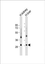 UNC119B Polyclonal Antibody