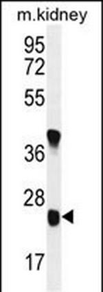 UNC119B Antibody in Western Blot (WB)