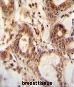NUDT15 Polyclonal Antibody