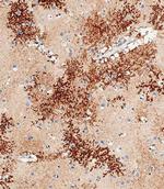 OTUD3 Antibody in Immunohistochemistry (Paraffin) (IHC (P))