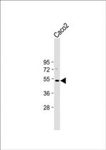 OTUD3 Antibody in Western Blot (WB)