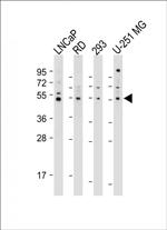 OTUD3 Antibody in Western Blot (WB)