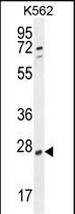 RPEL1 Polyclonal Antibody