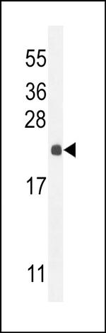 RPEL1 Antibody in Western Blot (WB)