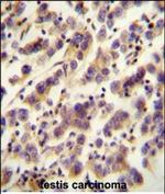 OR1J4 Polyclonal Antibody