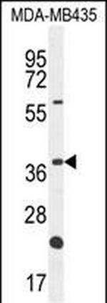 OR6V1 Polyclonal Antibody