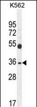 SULT1C3 Antibody in Western Blot (WB)