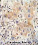 NR0B2 Antibody in Immunohistochemistry (Paraffin) (IHC (P))