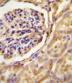 GNAT2 Polyclonal Antibody