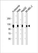LAMP2 Antibody in Western Blot (WB)