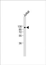 LAMP2 Antibody in Western Blot (WB)